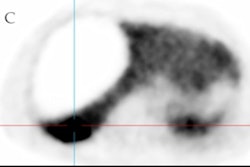 2023 01 20 17 21 6554 2023 01 20 Pet Hcc 400