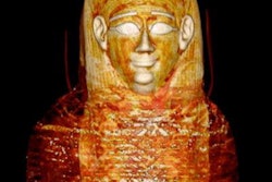 2023 01 24 17 45 2135 2023 01 24 Golden Mummy 3 D Ct Criss Cross Wrappings 20230124172355