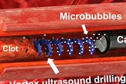 2023 01 24 21 55 4166 2023 01 23 Ultrasound Tornado 400