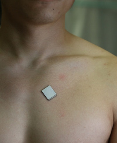 The wearable ultrasound sensor is roughly the size of a postage stamp, can be worn for up to 24 hours, and works even during strenuous exercise. Image courtesy of the Xu Laboratory, University of California, San Diego Jacobs School of Engineering.