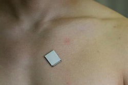 2023 01 27 00 56 6226 2023 01 25 Ultrasound Patch 20230127001313