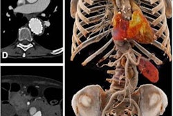 2023 01 27 19 07 4266 2023 01 26 Rad Cardiothor Imag Higashigaito Figure5 20230127191738