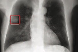 2023 01 31 01 14 3343 2023 01 31 Dr Chest 20230131010123