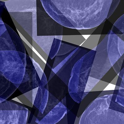 2019 04 22 21 09 3035 Mri Abstract 20190422211344