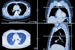 2021 09 13 18 10 0711 Lung Ct Images 400