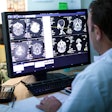 2022 10 27 22 50 7217 Radiologist Brain Scans Monitor 400