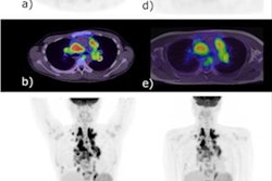 2023 02 02 01 18 7487 2023 02 01 Pet Lymphoma 20230202013221