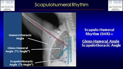 An x-ray from dynamic digital radiography of the shoulder illustrates the angles used to measure the scapulohumeral rhythm in shoulders of patients with rotator cuff tears. Image courtesy of senior author Dr. Eric Wagner, Department of Orthopaedic Surgery, Emory University, Atlanta, GA.