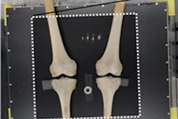 2023 02 06 23 09 6654 2023 02 06 Knee X Ray 20230206231407