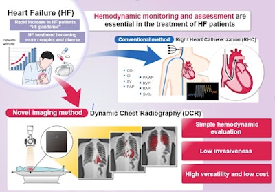 A graphical abstract. Hemodynamic assessment is essential for heart failure monitoring and assessment; however, it is invasive and is associated with complications. Dynamic chest x-ray (DCR) is a novel, minimally invasive, low-cost, and versatile imaging modality that can be used to visualize cardiac and pulmonary blood flow as pixel values, which correlate with hemodynamic parameters. Thus, DCR may be a useful alternative to estimate hemodynamic parameters in patients with HF. Image and caption courtesy of the European Journal of Radiology through CC BY 4.0.