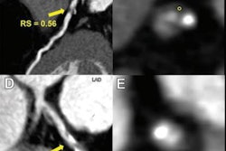 2023 02 14 00 18 0212 2023 02 14 Radiology Ccta 20230214004031