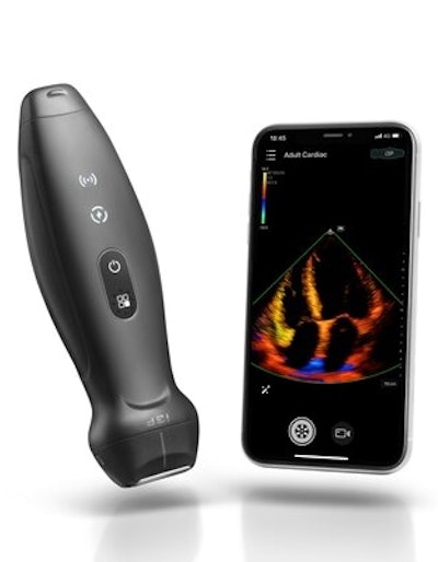 Mindray's TE Air, the company's first wireless handheld ultrasound system. Image courtesy of Mindray.