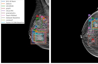 (A, B) Examples of DBT volumes containing annotated lesions that were the easiest to detect. On average, all 10 algorithms detected lesions in A and with 0.13 and 0.16 false positives, respectively. Detection bounding boxes indicate submitted algorithm predictions. The number in the upper-left corner of each box indicates the percentile of the corresponding algorithm's score with respect to the distribution of all algorithm scores for the volume. At most, two boxes per algorithm are shown, and the colors of each algorithm's boxes correspond to the free-response receiver operating characteristic curves. Images courtesy of Nicholas Konz.