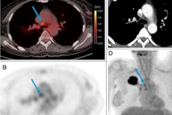 2023 02 24 21 43 2011 2023 02 24 Pet Lymph Node 400