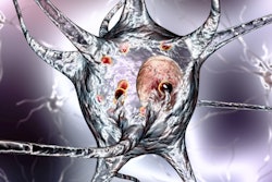 2021 01 12 22 23 5010 Parkinsons Neuron 400