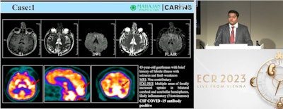Dr. Nikhil Seniaray of Mahajan Imaging in New Delhi, India, presented a study March 2 that looked at brain imaging findings in patients with COVID-19.