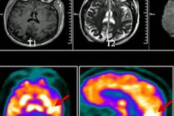 2023 03 03 03 55 1350 2023 03 03 Pet Ct Covid 20230303032421
