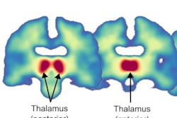 2023 03 07 01 51 4548 2023 03 07 Aromatase 400