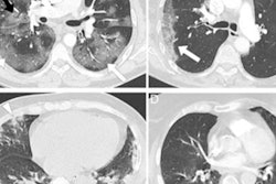 2023 03 07 22 39 0399 2023 03 08 Ct Omicron 20230307223352