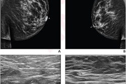 2023 03 08 21 41 5365 2023 03 08 Ultrasound Lymphadenopathy 20230308212727