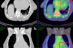 2023 03 09 21 46 9188 2023 03 09 Cardiac Amyloidosis 20230309210431