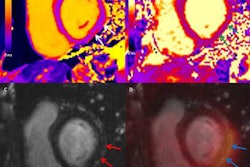 2023 03 10 21 32 6955 2023 03 13 Pet Mri Myocarditis 20230310214641