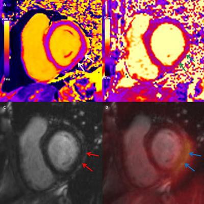 2023 03 10 21 32 6955 2023 03 13 Pet Mri Myocarditis 20230310214641