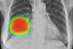 2023 03 16 20 27 2296 2023 03 15 Insight Cxr Chest 20230316203256