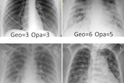 2023 03 21 22 19 0333 2023 03 22 Covid 19 Lungs 20230321223343