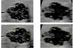 2023 03 24 19 00 0637 2023 03 26 Vsi Ai Breast 400