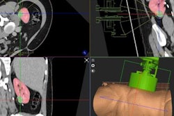 2023 03 30 19 02 6291 2023 03 30 Histo Sonics 20230330190145