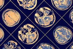2018 11 19 19 27 1139 Mri Brain 400