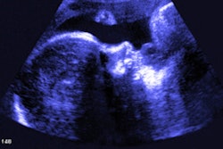 2019 04 15 23 11 1614 Fetal Ultrasound 400