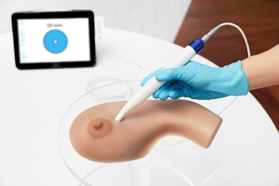 Molli 2 wand detecting marker on breast phantom. Image courtesy of Molli Surgical.