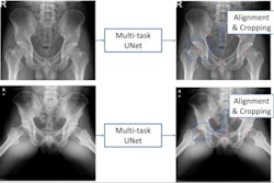 2023 04 05 18 37 4495 2023 04 05 Dl Hip 400