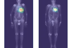 2023 04 14 21 38 4654 2023 04 14 Ai Scintigraphy 20230414210805