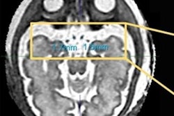 2023 04 17 17 03 8624 2023 04 17 Arrs 3 D Svr Mri 20230417170854