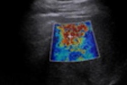 2023 04 17 23 43 7196 2023 04 17 Arrs Elastography Pierce 20230417232411