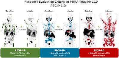 An image presented April 16 by Dr. Don Yoo during the ARRS annual meeting. The image is a graphic abstract from a study published April, 14, 2022 in the Journal of Nuclear Medicine and made available through CC BY 4.0.
