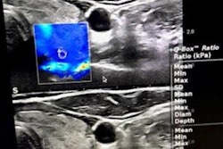 2023 04 18 17 24 2443 2023 04 18 Arrs Elastography Thyroid 20230418175206