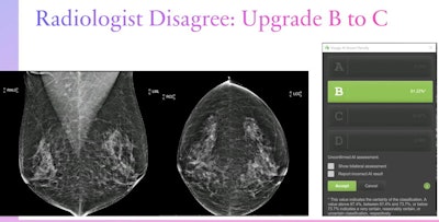 Dr. Lianne Philpotts from Yale University presented her team's findings on an AI model's agreement with radiologists on breast density classification at the ARRS annual meeting. The team found that the model showed over 99% agreement with radiologists of varying image reading volumes, indicating that it could be used in breast cancer screening as an adjunct or standalone assessment tool. Here, a radiologist disagreed with the model's assessment of a category B density designation and upgraded this case to a category C. Images courtesy of ARRS.