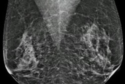 2023 04 19 16 30 1087 2023 04 18 Arrs Ai Breast Density 20230419163449