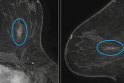 2023 04 20 18 50 0944 2023 04 18 Arrs Dbt 20230420183647