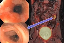 2023 04 20 20 35 0501 2023 04 20 Pet Crohns 400