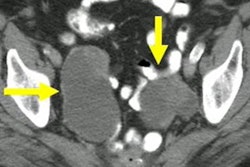 2023 04 20 22 18 0393 2023 04 19 Arrs Pelvic Tvus 20230420225113