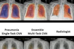 2023 04 21 17 43 8046 2023 04 24 Ai Pneumonia 20230424151312