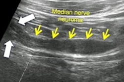 2023 04 21 22 20 2222 2023 04 18 Arrs Ultrasound Mri Brachial Plexus 20230421223054