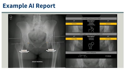 An example report generated by the AI algorithm IB Lab Hippo for each x-ray used in the study. Image courtesy of Holden Archer.