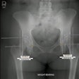 2023 04 24 20 06 3937 2023 04 25 Ai Hip Dysplasia 20230424203520