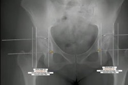 2023 04 24 20 06 3937 2023 04 25 Ai Hip Dysplasia 20230424203520